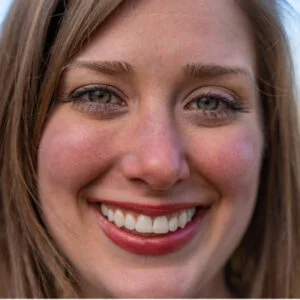 Wrinkle relaxing treatments